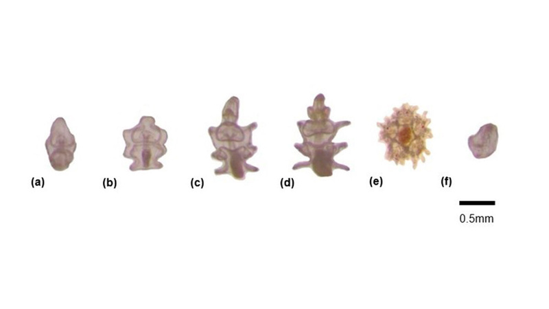Developmental stages of Acanthaster planci larvae