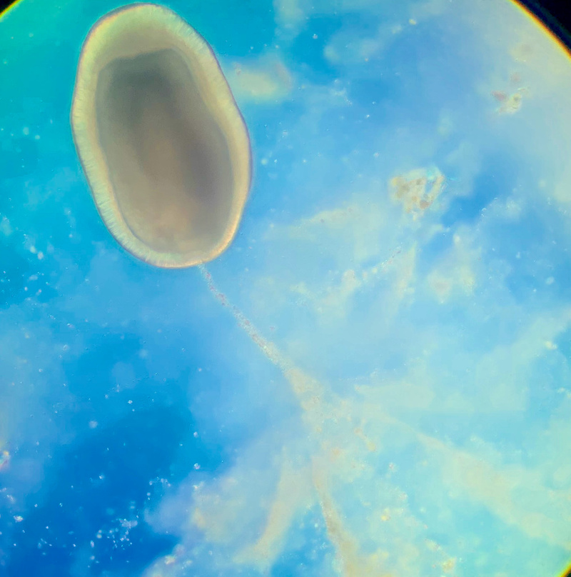 Coral larvae captures food particles with mucous net credit Colleen Rodd