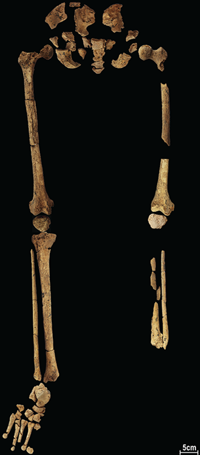 Fossil skeleton showing amputated lower leg
